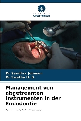 Management von abgetrennten Instrumenten in der Endodontie - Dr Sandhra Johnson, Dr Swetha H B