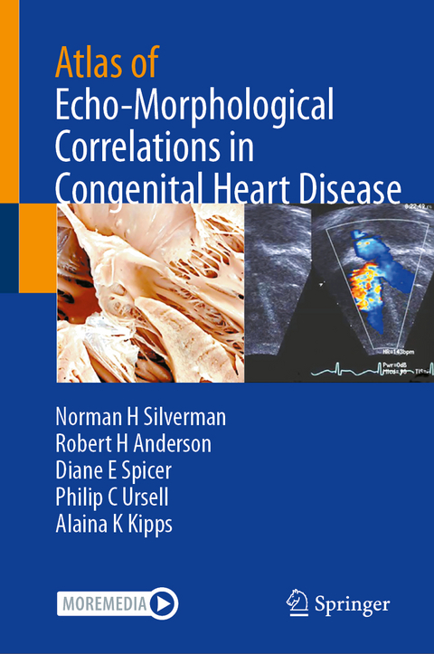 Atlas of Echo-Morphological Correlations in Congenital Heart Disease - Norman H Silverman, Robert H Anderson, Diane E Spicer, Philip C Ursell, Alaina K Kipps