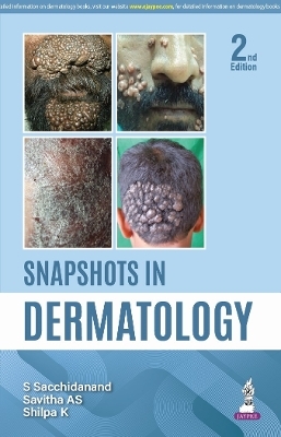 Snapshots in Dermatology - S Sacchidanand, Savitha AS, Shilpa K, Chaithra S