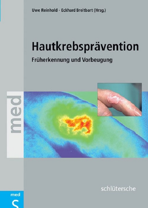 Hautkrebspr&auml;vention - 