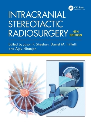Intracranial Stereotactic Radiosurgery