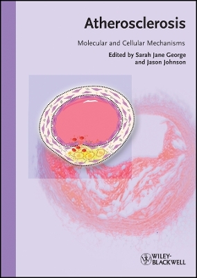Atherosclerosis – Molecular and Cellular Mechanisms
