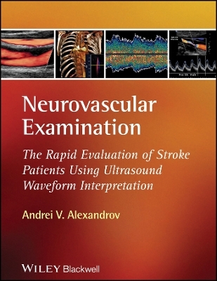 Neurovascular Examination – The Rapid Evaluation of Stroke Patients Using Ultrasound Waveform Interpretation