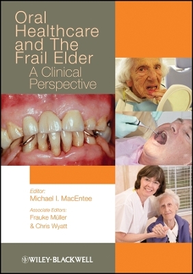 Oral Healthcare and the Frail Elder - M MacEntee
