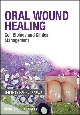 Oral Wound Healing &ndash; Cell Biology and Clinical Management - H Larjava