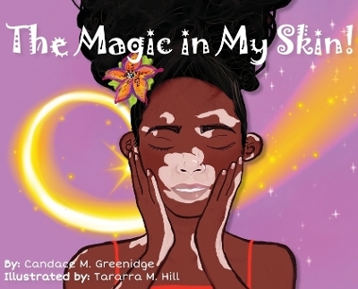 The Magic in My Skin! - Candace M Greenidge