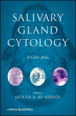 Salivary Gland Cytology – A Color Atlas