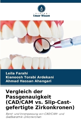 Vergleich der Passgenauigkeit (CAD/CAM vs. Slip-Cast-gefertigte Zirkonkronen) - Leila Farahi, Kianoosh Torabi Ardekani, Ahmad Hassan Ahangari