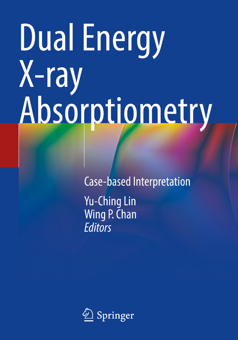Dual Energy X-ray Absorptiometry - 