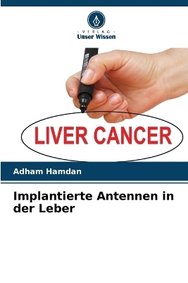 Implantierte Antennen in der Leber - Adham Hamdan