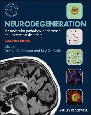 Neurodegeneration – The Molecular Pathology of Dementia and Movement Disorders