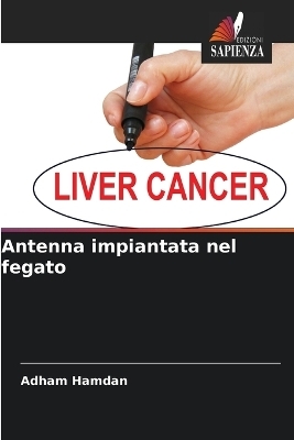 Antenna impiantata nel fegato