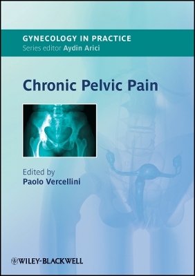 Chronic Pelvic Pain - 