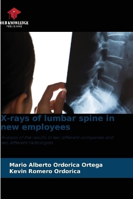 X-rays of lumbar spine in new employees