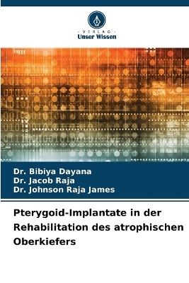 Pterygoid-Implantate in der Rehabilitation des atrophischen Oberkiefers
