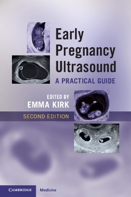 Early Pregnancy Ultrasound - 