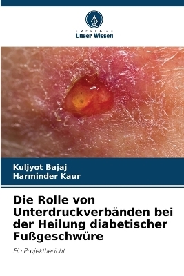 Die Rolle von Unterdruckverbänden bei der Heilung diabetischer Fußgeschwüre