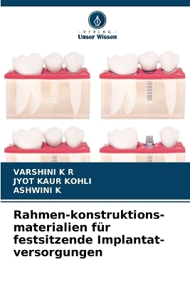 Rahmen-konstruktions-materialien f&uuml;r festsitzende Implantat-versorgungen - Varshini K R, Jyot Kaur Kohli, ASHWINI K