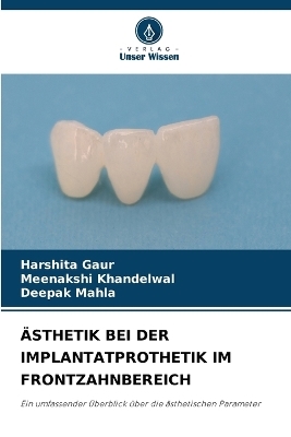 Ästhetik Bei Der Implantatprothetik Im Frontzahnbereich