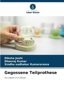 Gegossene Teilprothese - Diksha Joshi, Dheeraj Kumar, Sindhu Sudhakar Kumararama