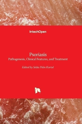 Psoriasis - Pathogenesis, Clinical Features, and Treatment