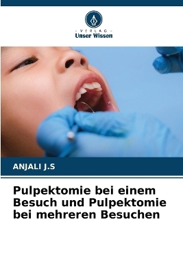 Pulpektomie bei einem Besuch und Pulpektomie bei mehreren Besuchen