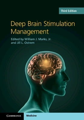 Deep Brain Stimulation Management - 