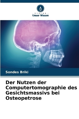 Der Nutzen der Computertomographie des Gesichtsmassivs bei Osteopetrose - Sondes Briki