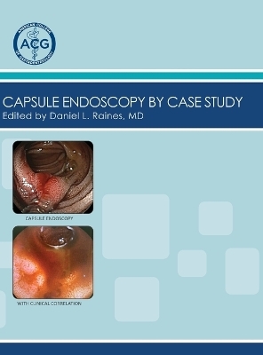 Capsule Endoscopy by Case Study, Volume 2 - 