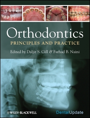 Orthodontics – Principles and Practice