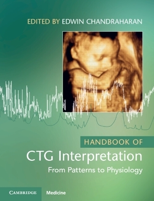 Handbook of CTG Interpretation - 