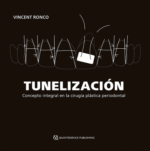 Tunelizaci&oacute;n - Vincent Ronco