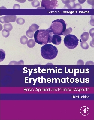 Systemic Lupus Erythematosus