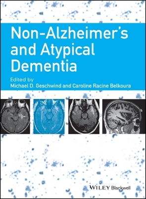 Non&ndash;Alzheimer&prime;s and Atypical Dementia - MD Geschwind