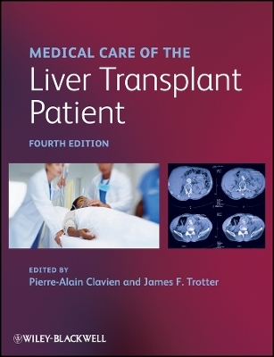 Medical Care of the Liver Transplant Patient 4e - 