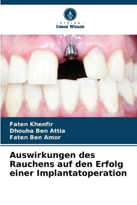Auswirkungen des Rauchens auf den Erfolg einer Implantatoperation - Faten Khenfir, Dhouha Ben Attia, Faten Ben Amor