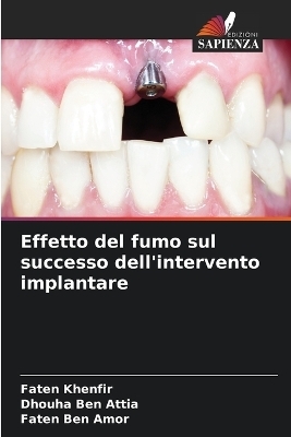 Effetto del fumo sul successo dell'intervento implantare