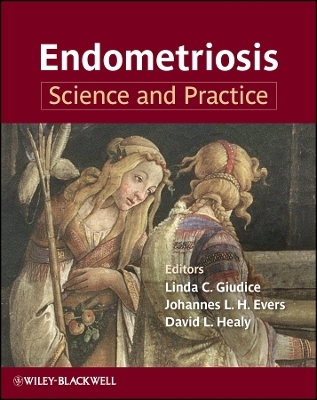 Endometriosis &ndash; Science and Practice - 