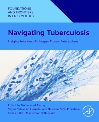 Navigating Tuberculosis - 