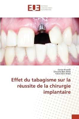 Effet du tabagisme sur la r&eacute;ussite de la chirurgie implantaire - Faten Khenfir, Dhouha Ben Attia, Faten Ben Amor