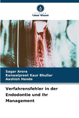 Verfahrensfehler in der Endodontie und ihr Management - Sagar Arora, Kanwalpreet Kaur Bhullar, Aashish Handa
