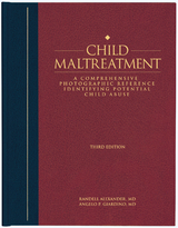 Child Maltreatment 3e, Volume 2 - Angelo Giardino, Randell Alexander