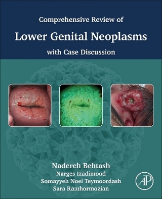 Comprehensive review of lower genital neoplasms