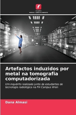 Artefactos induzidos por metal na tomografia computadorizada