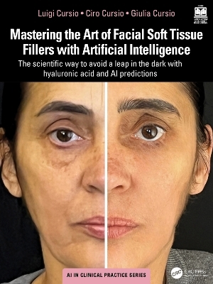 Mastering the Art of Facial Soft Tissue Fillers with Artificial Intelligence - Luigi Cursio, Ciro Cursio, Giulia Cursio