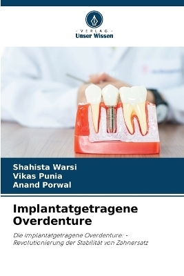 Implantatgetragene Overdenture