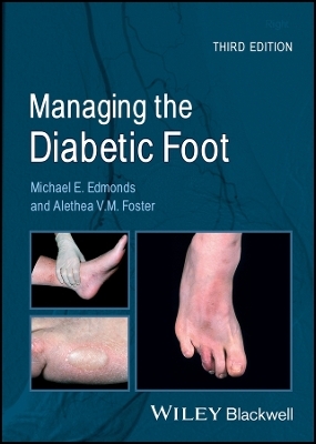 Managing the Diabetic Foot - M Edmonds
