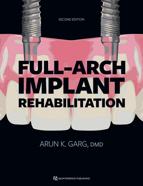 Full-Arch Implant Rehabilitation - Arun K. Garg