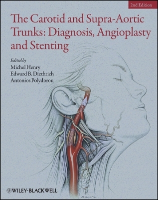 The Carotid and Supra&ndash;Aortic Trunks &ndash; Angioplasty and Stenting of the Diagnosis. - Michel Henry, Edward B. Diethrich, Antonios Polydorou
