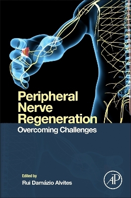 Peripheral Nerve Regeneration